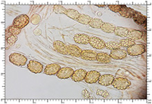 Genea hispidula